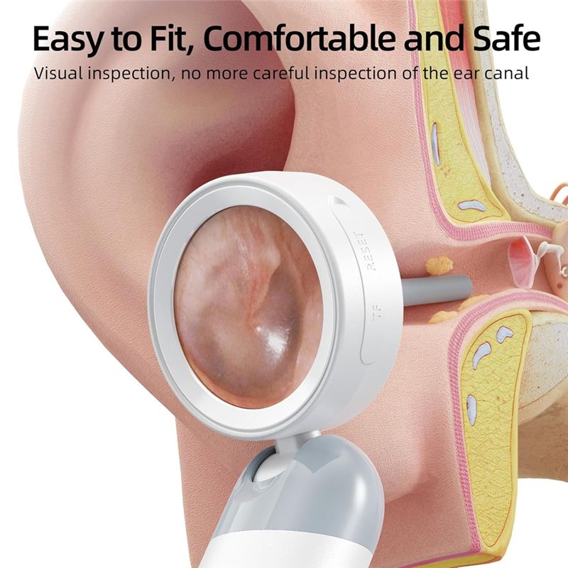 LXYB18B Wireless Ear Otoscope  - đánh giá và giá Macro Photography Led Lighting