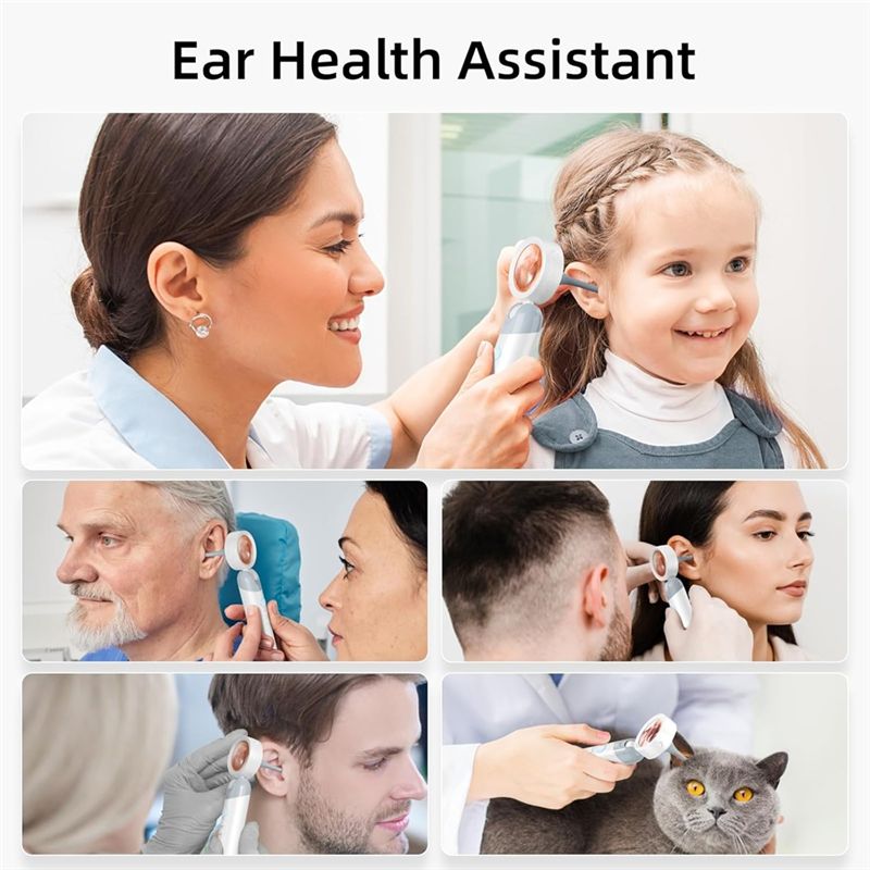 LXYB18B Wireless Ear Otoscope  - đánh giá và giá Macro Photography Led Lighting