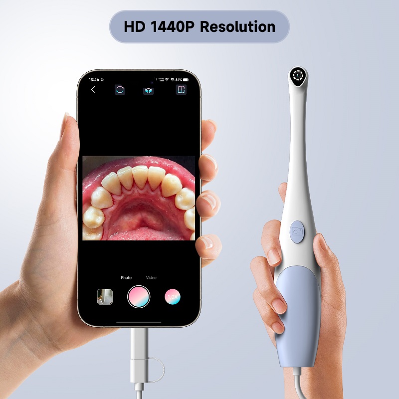 Oral Endoscope Camera 1440P Ph - đánh giá và giá Macro Photography Led Lighting