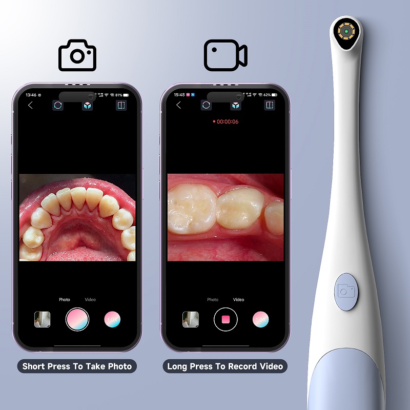 Oral Endoscope Camera 1440P Ph - đánh giá và giá Macro Photography Led Lighting